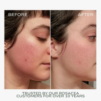 Fitglow Beauty Redness Rescue Cream - The Green Kiss